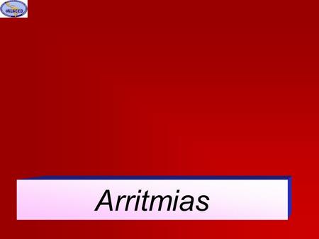 Arritmias.