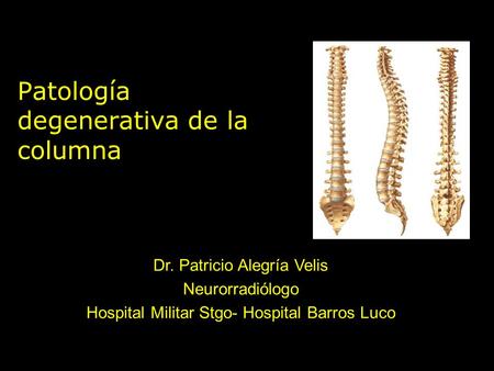 Patología degenerativa de la columna