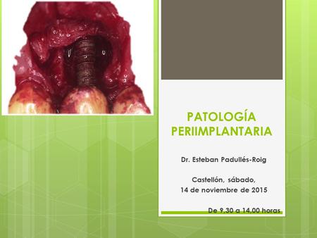 PATOLOGÍA PERIIMPLANTARIA Dr. Esteban Padullés-Roig Castellón, sábado, 14 de noviembre de 2015 De 9,30 a 14,00 horas.