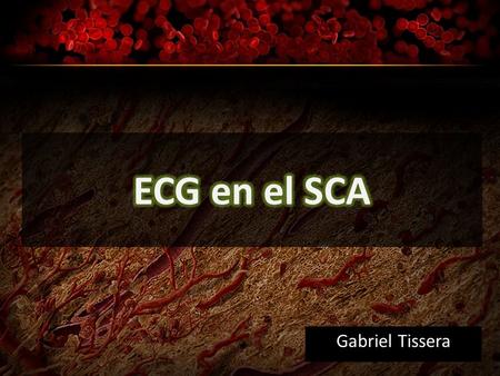 Gabriel Tissera. Síndrome coronario agudo JACC 2000, (36): 959- 69 Dx Ingreso Dx en la evolución Dx Inicial.
