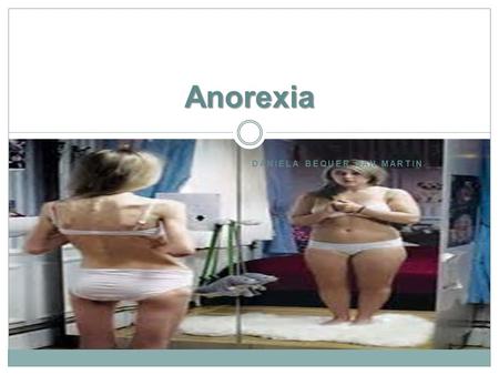 DANIELA BEQUER SAN MARTIN Anorexia. Índice ¿Qué es? Síntomas ¿A quienes afecta?