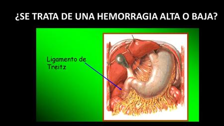 ¿SE TRATA DE UNA HEMORRAGIA ALTA O BAJA?