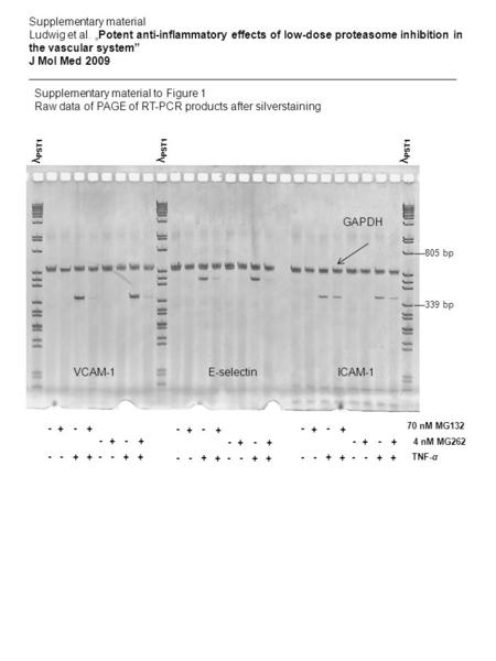 Supplementary material to Figure 1 Raw data of PAGE of RT-PCR products after silverstaining VCAM-1E-selectinICAM-1 GAPDH TNF-α + + -- + + -- - + - + -