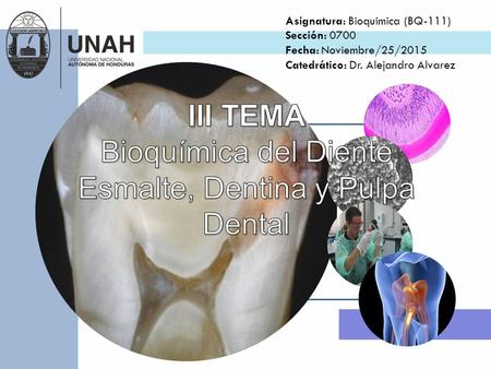Esmalte, Dentina y Pulpa Dental