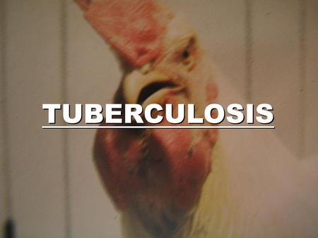 TUBERCULOSIS.