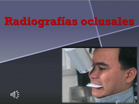 Radiografías oclusales