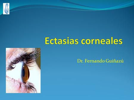 Ectasias corneales Dr. Fernando Guiñazú.