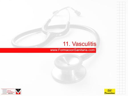 11. Vasculitis www.FormacionSanitaria.com.