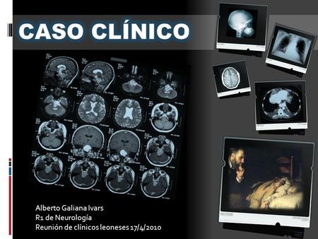 CASO CLÍNICO Alberto Galiana Ivars R1 de Neurología
