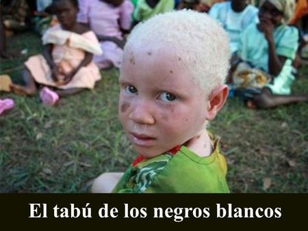 El tabú de los negros blancos