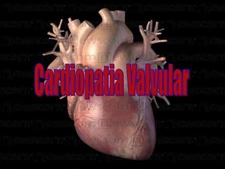                                                                                                                                  Cardiopatia Valvular CARDIOPATIA.