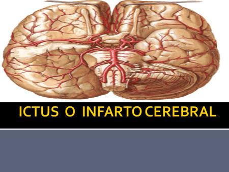 ICTUS O INFARTO CEREBRAL