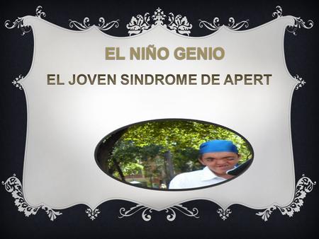 EL JOVEN SINDROME DE APERT