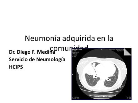 Neumonía adquirida en la comunidad