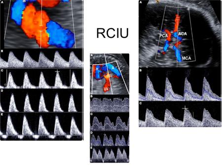 RCIU.