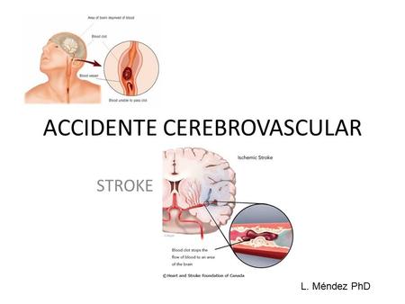 ACCIDENTE CEREBROVASCULAR STROKE L. Méndez PhD. Objetivos Al finalizar la conferencia los estudiantes de CCNA 665 podrán: 1- Repasar aspectos relevantes.