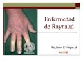 Enfermedad de Raynaud Ps Jaime E Vargas M A515TE.