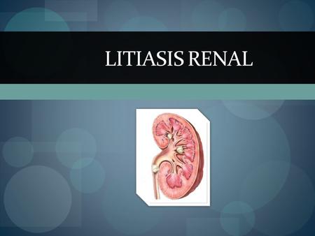 LITIASIS RENAL.