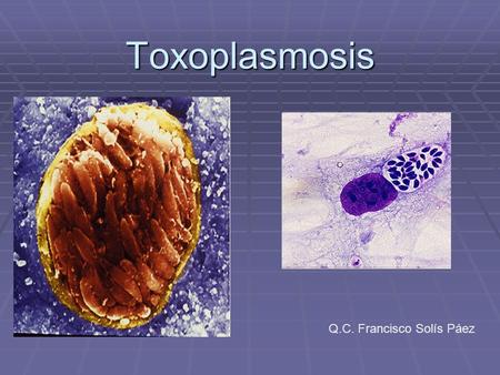 Toxoplasmosis Q.C. Francisco Solís Páez.