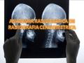 ANATOMIA RADIOGRAFICA EN RADIOGRAFIA CEFALOMETRICA
