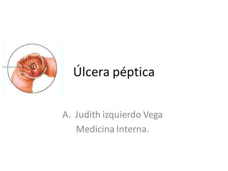 Judith izquierdo Vega Medicina Interna.