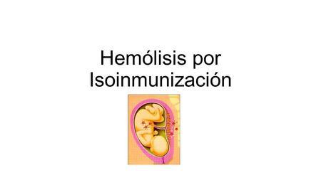 Hemólisis por Isoinmunización