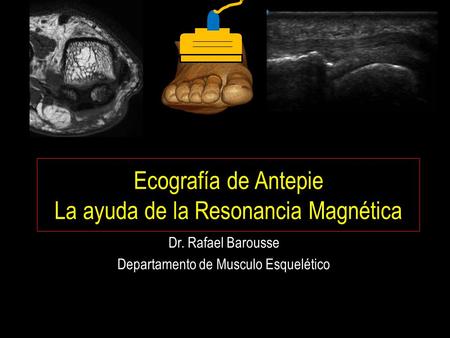 Ecografía de Antepie La ayuda de la Resonancia Magnética