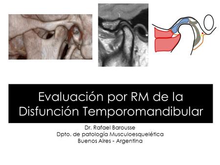 Evaluación por RM de la Disfunción Temporomandibular