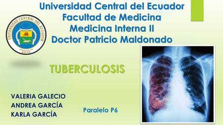Universidad Central del Ecuador Facultad de Medicina Medicina Interna II Doctor Patricio Maldonado VALERIA GALECIO ANDREA GARCÍA KARLA GARCÍA TUBERCULOSIS.