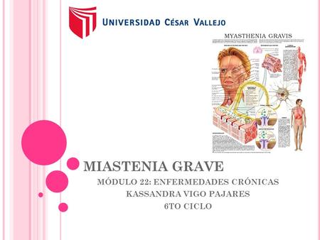 MÓDULO 22: ENFERMEDADES CRÓNICAS KASSANDRA VIGO PAJARES 6TO CICLO