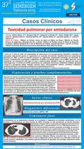 Toxicidad pulmonar por amiodarona (TPA) Sánchez S, Zamora E, Hoyos N, Naranjo A, Nakeeb A y Girón RM. Fibrosis pulmonar por amiodarona. Rev Patol Respir.