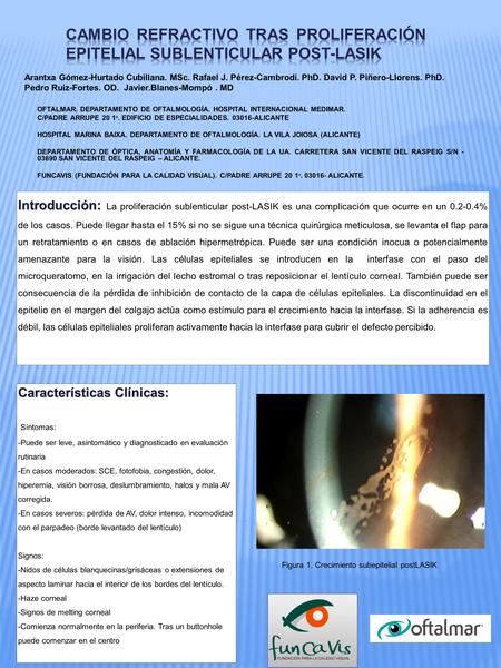 OFTALMAR. DEPARTAMENTO DE OFTALMOLOGÍA. HOSPITAL INTERNACIONAL MEDIMAR. C/PADRE ARRUPE 20 1 º. EDIFICIO DE ESPECIALIDADES. 03016-ALICANTE HOSPITAL MARINA.