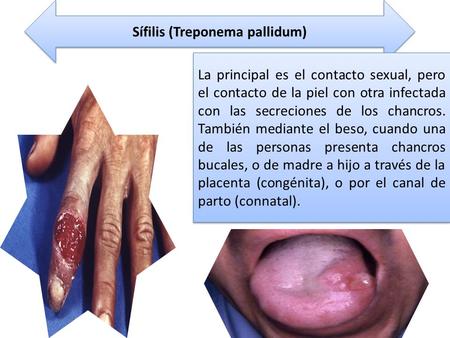 Sífilis (Treponema pallidum) La principal es el contacto sexual, pero el contacto de la piel con otra infectada con las secreciones de los chancros. También.