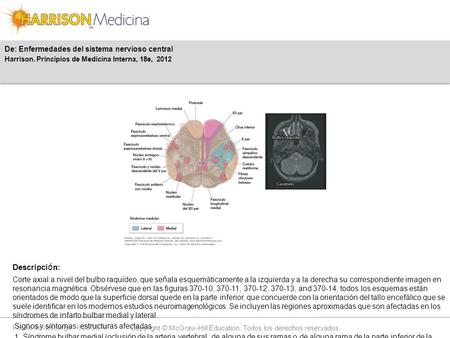 Fecha de descarga: 6/25/2016 Copyright © McGraw-Hill Education. Todos los derechos reservados. Corte axial a nivel del bulbo raquídeo, que señala esquemáticamente.