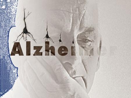 HISTORIA Descrito por primera vez en 1907 por el médico alemán Alois Alzheimer En un paciente de 51 años que falleció tras 5 años de demencia Hasta 1970.