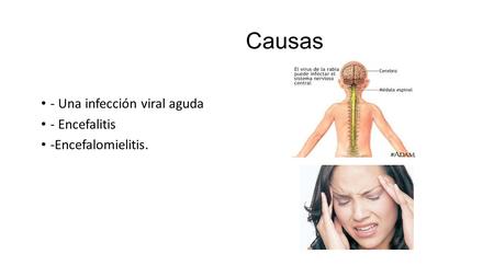 Causas - Una infección viral aguda - Encefalitis -Encefalomielitis.