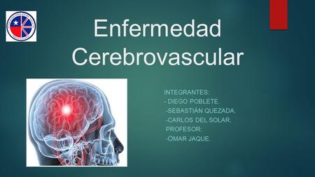 Enfermedad Cerebrovascular INTEGRANTES: - DIEGO POBLETE. -SEBASTIÁN QUEZADA. -CARLOS DEL SOLAR. PROFESOR : - O MAR JAQUE.