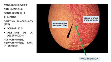 MUESTRA: HIPOFISIS N DE LAMINA: 49 COLORACION: H - E AUMENTO: OBJETIVO: PANORAMICO (10X)  OCULAR: 12.5  OBJETIVOS DE LA OBSERVACION: ADENOHIPOFISIS,