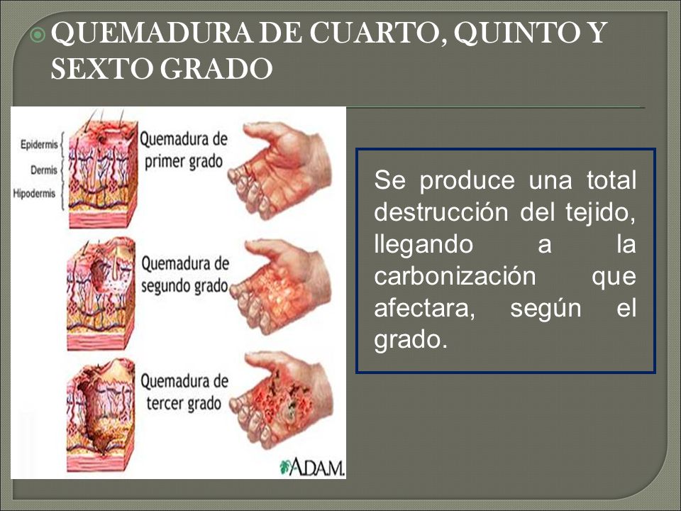 Las quemaduras son las lesiones resultantes de la acción físicos ... Las quemaduras son las lesiones resultantes de la acción físicos ...
