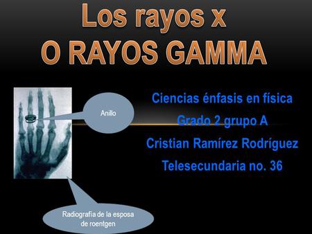 Los rayos x o rayos gamma