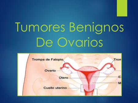 Tumores Benignos De Ovarios