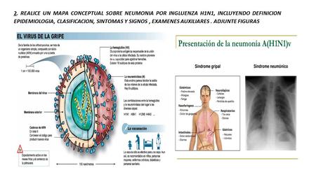 2. REALICE UN MAPA CONCEPTUAL SOBRE NEUMONIA POR INGLUENZA H1N1, INCLUYENDO DEFINICION EPIDEMIOLOGIA, CLASIFICACION, SINTOMAS Y SIGNOS, EXAMENES AUXILIARES.