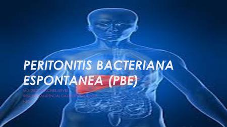 PERITONITIS BACTERIANA ESPONTANEA (PBE) MD. DIEGO RACINES JERVES RESIDENTE ASISTENCIAL GASTROENTEROLOGIA HJCA.