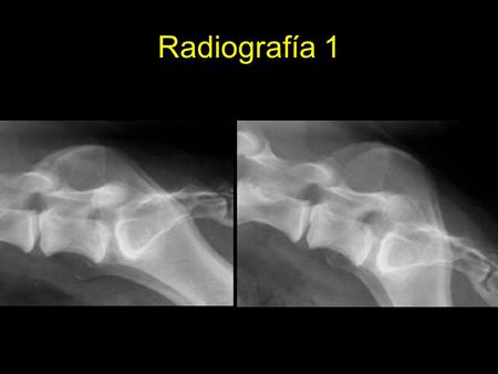 Radiografía 1. Radiografía 2 Radiografía 3 Radiografía 4.