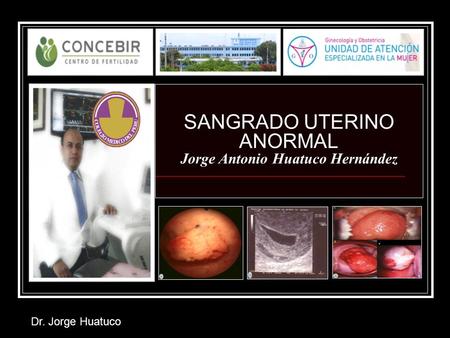 Dr. Jorge Huatuco SANGRADO UTERINO ANORMAL Jorge Antonio Huatuco Hernández.