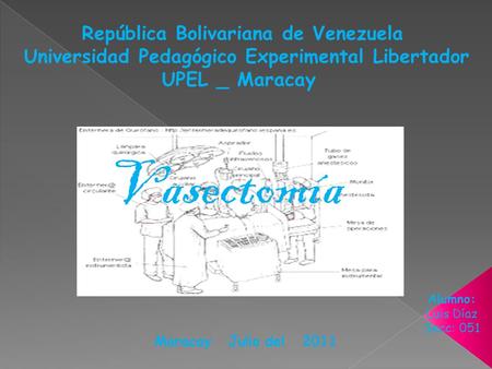 República Bolivariana de Venezuela Universidad Pedagógico Experimental Libertador UPEL _ Maracay Alumno: Luis Díaz Secc: 051 Maracay Julio del 2011 Vasectomía.