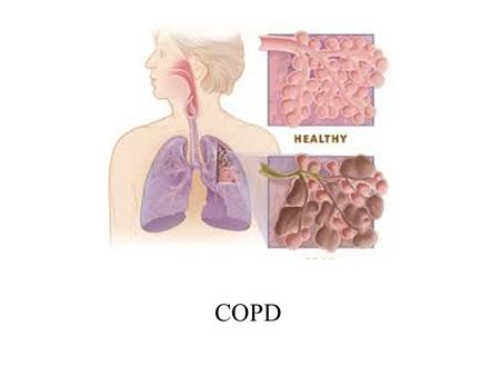 COPD. La enfermedad pulmonar obstructiva crónica, es una enfermedad progresiva que causa dificultad para respirar. La palabra “progresiva” indica que.