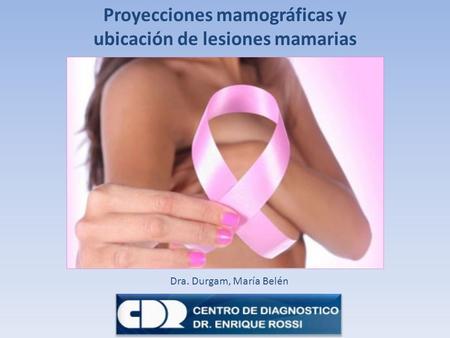 Proyecciones mamográficas y ubicación de lesiones mamarias
