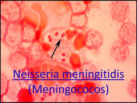 Neisseria meningitidis (Meningococos). Taxonomía Reino: Bacteria Filo: Proteobacteria Clase: Beta Proteobacteria Orden: Neisseriales Familia: Neisseriaceae.