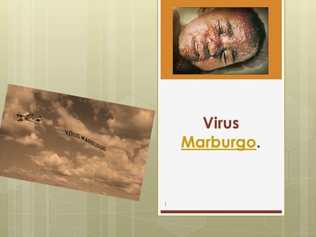 Virus Marburgo. Marburgo 1. 2 Estructura del virus Historia Replicación viral Anatomía patológica Patogénesis Modalidades de contagio Clínica Alteraciones.